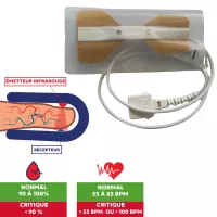 Capteur SPO2 usage unique pour oxymètre de pouls - Lot de 10