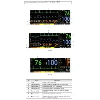 Moniteur multiparamétrique PRIZM 3 - Ecran Couleur