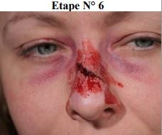 Maquillage secourisme fracture du nez étape 6