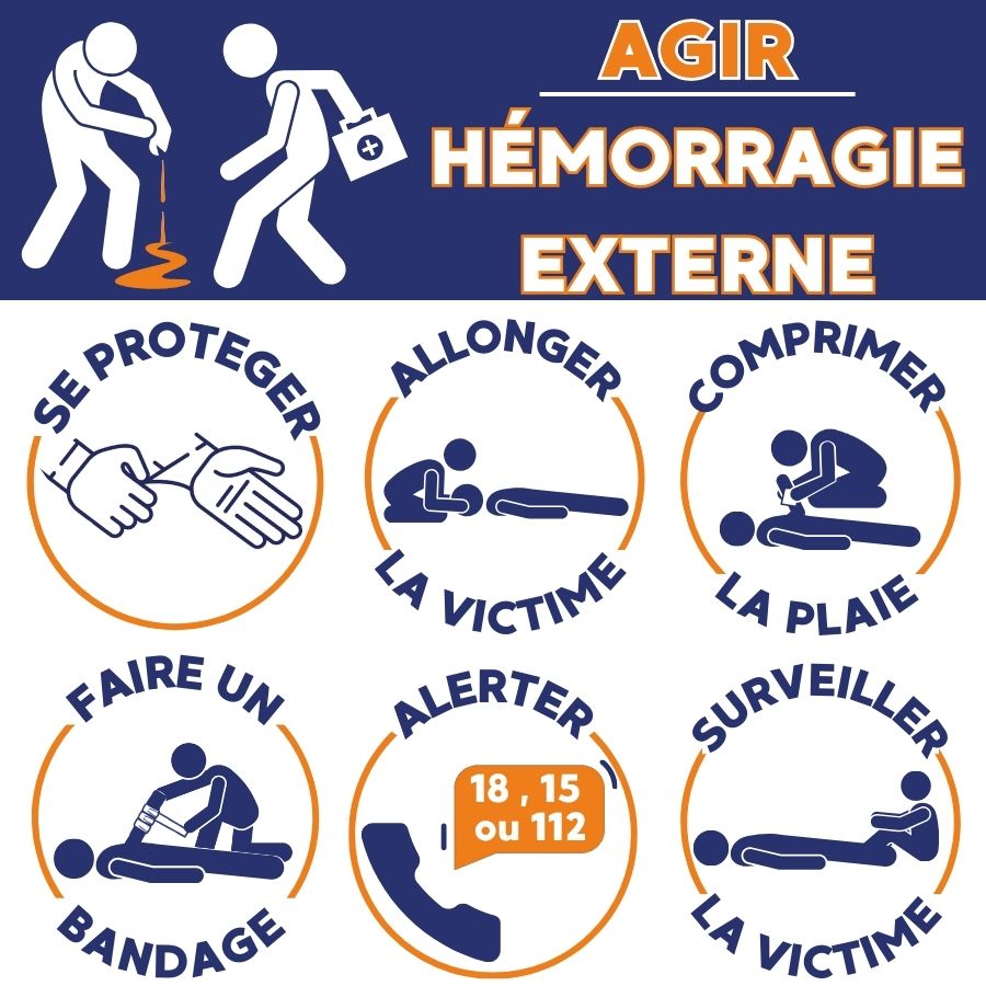 hémorragie externe 