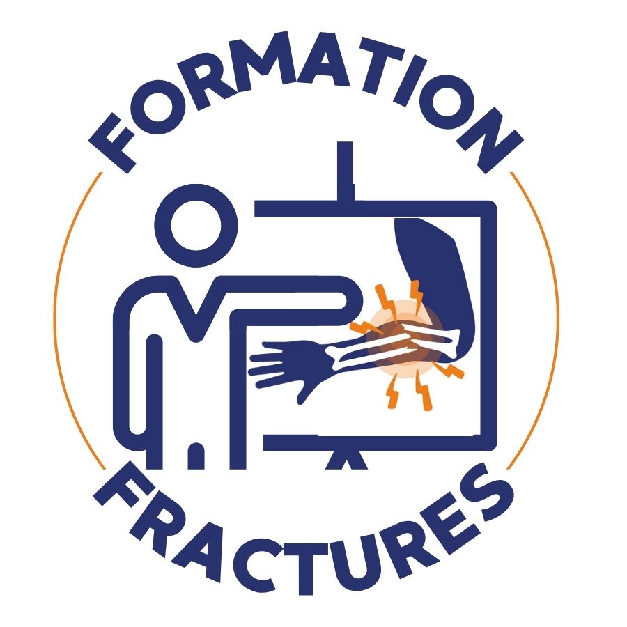 formation fracture
