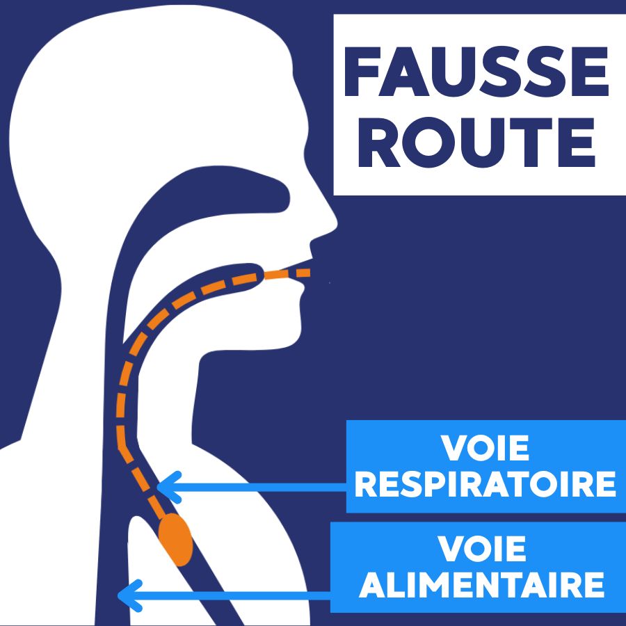 fausse route