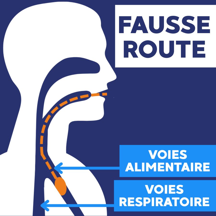 fausse route