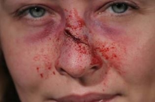 Maquillage secourisme : simuler un nez cassé