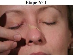 Maquillage secourisme fracture du nez étape 1