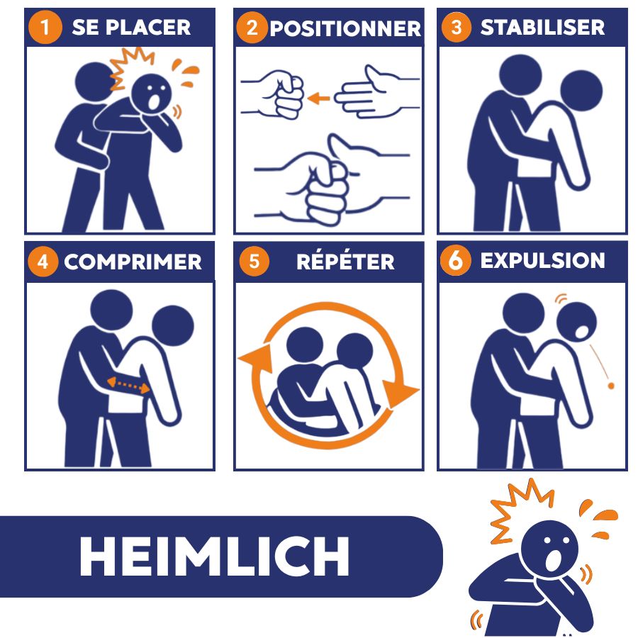 méthode Heimlich