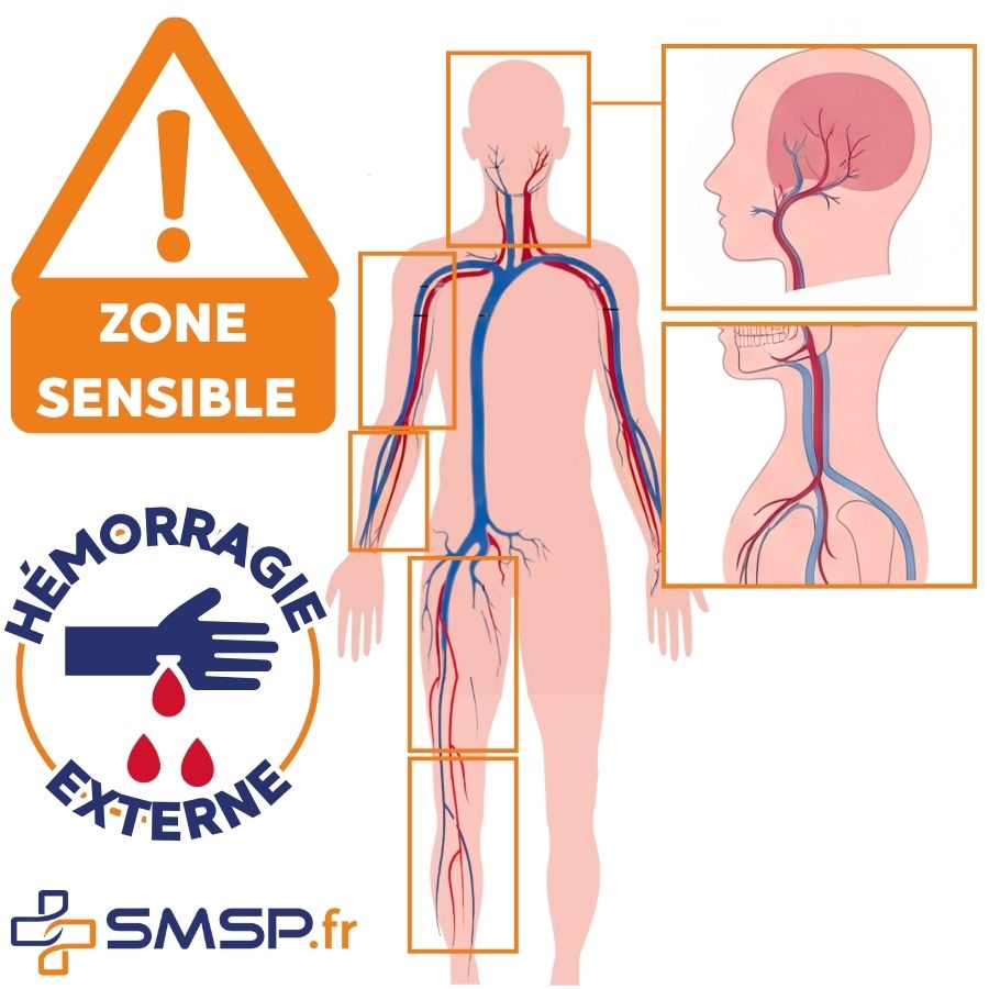 coussin hémostatique