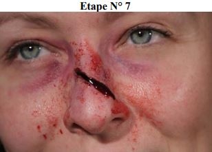 Maquillage secourisme fracture du nez étape 7