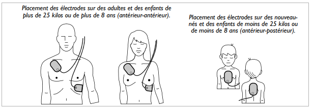 Electrodes smart pads 2