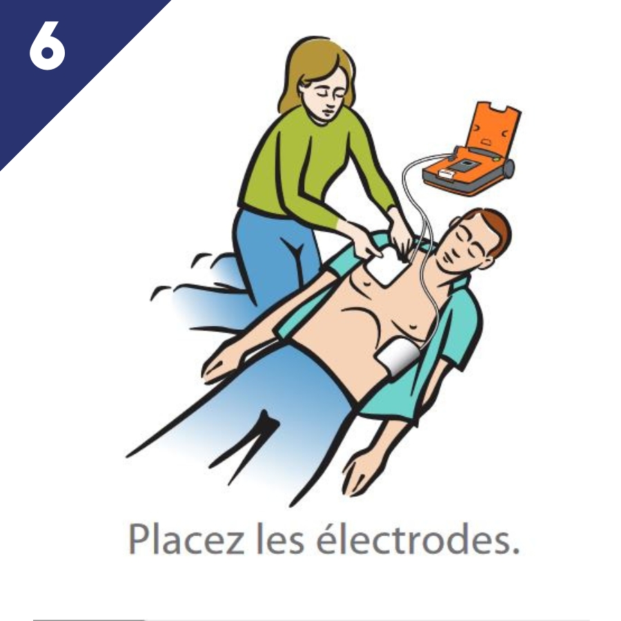 defibrillateur cardiaque